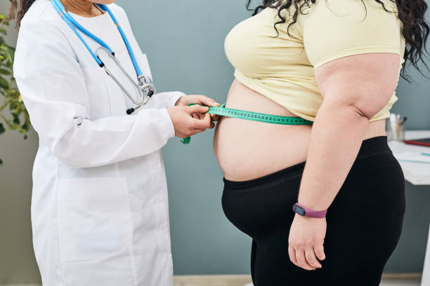 Obesity unhealthy weight nutritionist inspecting a womans waist using a meter tape to