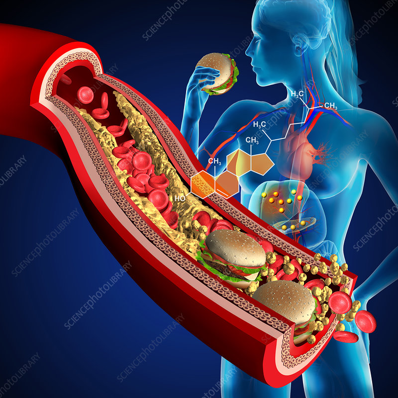 Cholesterol, Illustration